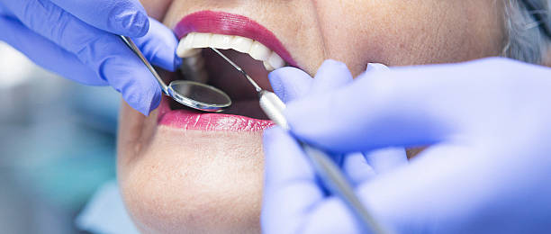 Best Emergency Dentist for Knocked-Out Tooth in Wfield, IN
